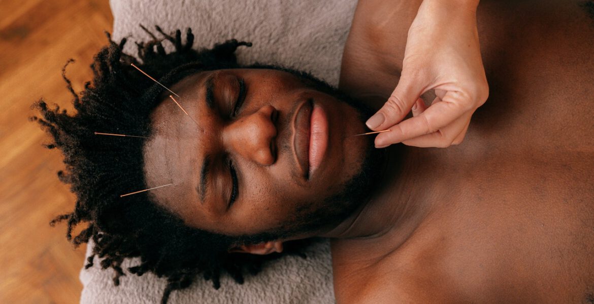 Man durning his acupuncture face treatment