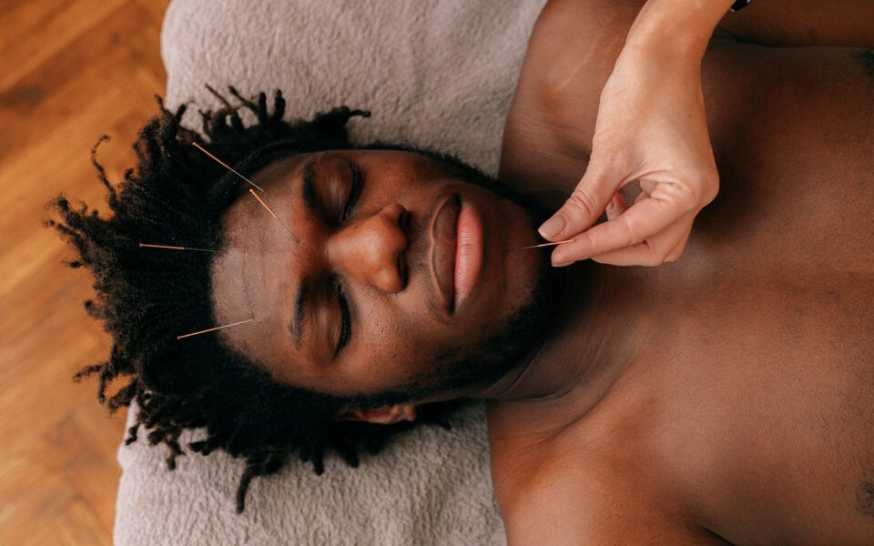 Man durning his acupuncture face treatment