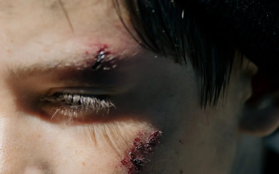 Man with weird personal injuries